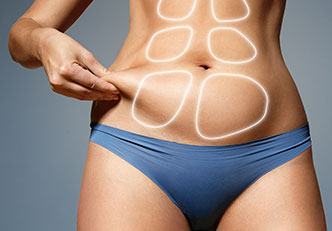 Lipoliz ile Bel Çevresi Eritme (Flanks & Love Handles)
