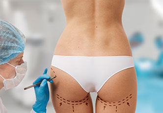 Popo Dolgusu (Brazilian Butt Lift - BBL Non-Surgical)