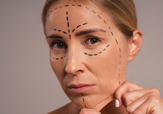 İp Askı (Thread Lift)