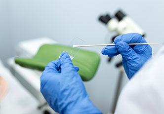 Pap Smear Testi